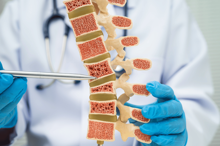 Osteopenia and Bone Health How to Rebuild Bone Density